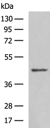 Rabbit Polyclonal Antibody to NCR1