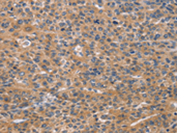 Rabbit Polyclonal Antibody to NCR2