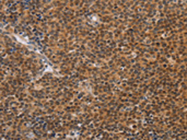 Rabbit Polyclonal Antibody to CD36