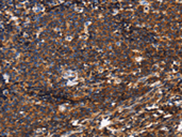 Rabbit Polyclonal Antibody to PTPRC