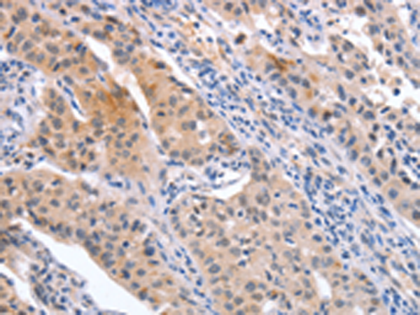 Rabbit Polyclonal Antibody to CD59