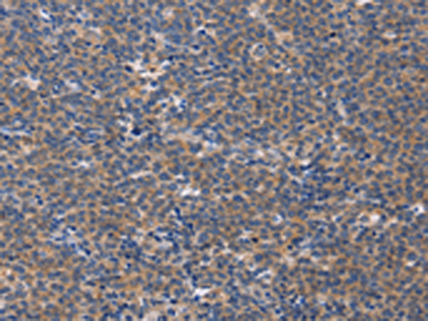 Rabbit Polyclonal Antibody to CD5L