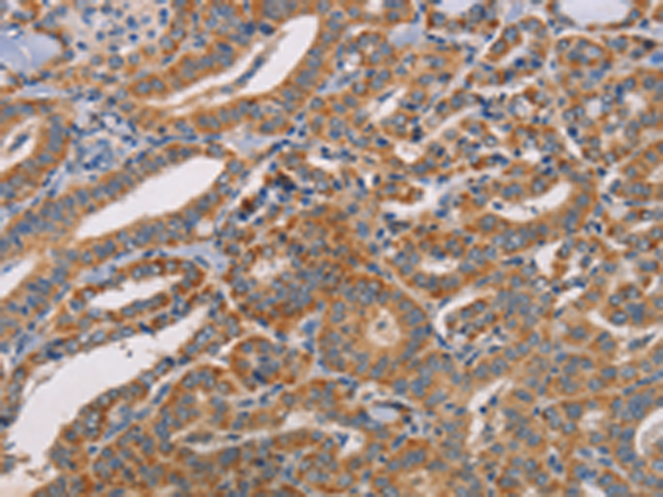 Rabbit Polyclonal Antibody to CDK11A/CDK11B