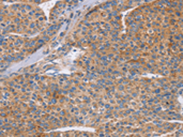 Rabbit Polyclonal Antibody to CDC7