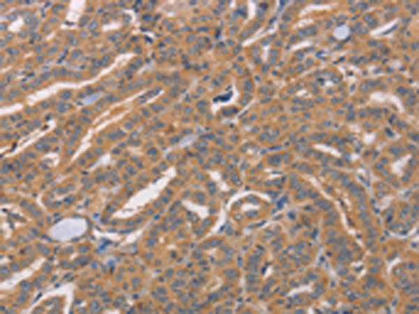 Rabbit Polyclonal Antibody to CDCA4