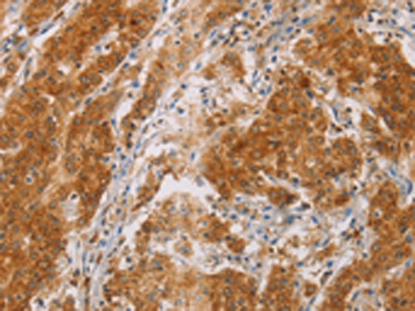 Rabbit Polyclonal Antibody to CENPE