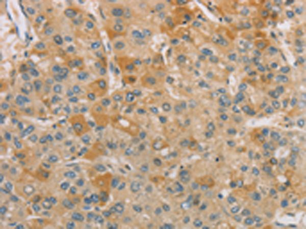 Rabbit Polyclonal Antibody to CENPF