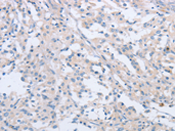 Rabbit Polyclonal Antibody to AGAP2