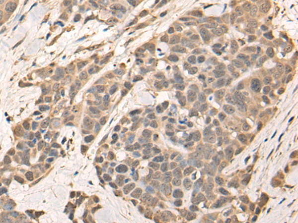 Rabbit Polyclonal Antibody to CHFR