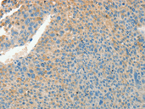 Rabbit Polyclonal Antibody to CHRDL2