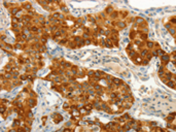 Rabbit Polyclonal Antibody to CIB1