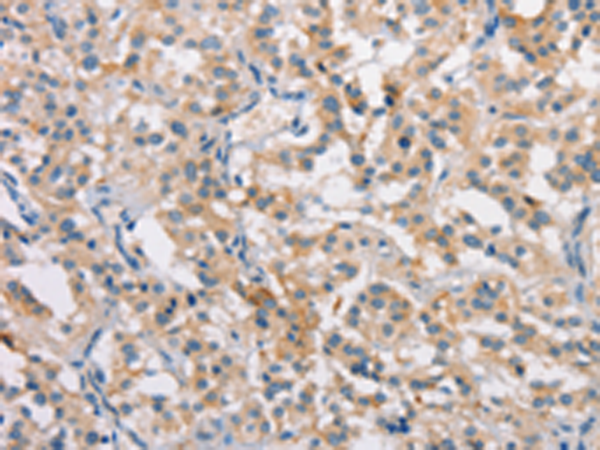 Rabbit Polyclonal Antibody to CLDN11