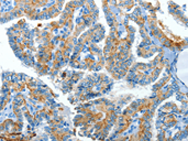 Rabbit Polyclonal Antibody to CLPTM1L