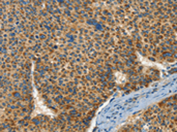 Rabbit Polyclonal Antibody to IFT74