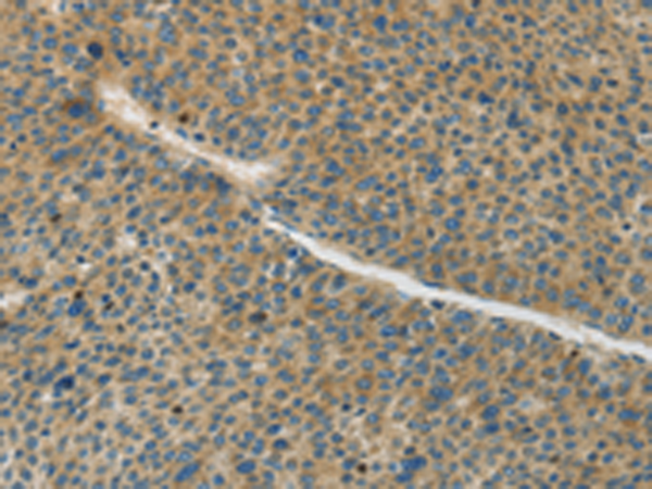 Rabbit Polyclonal Antibody to GJC1