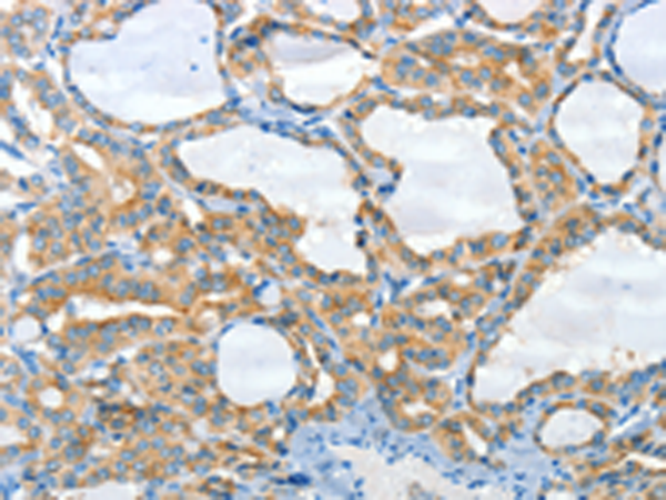 Rabbit Polyclonal Antibody to CNTNAP3