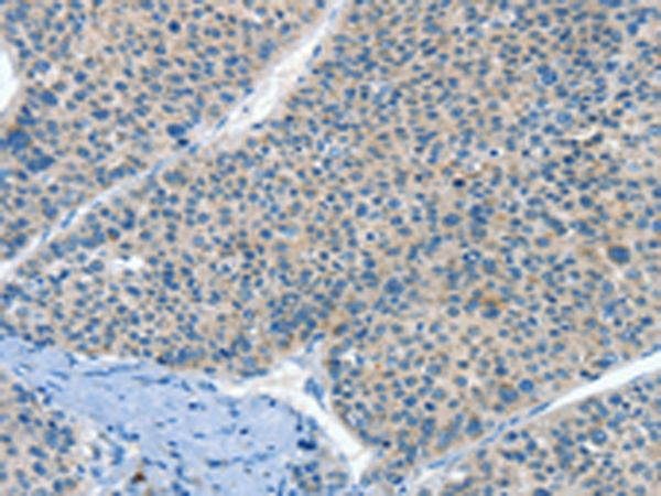Rabbit Polyclonal Antibody to HID1