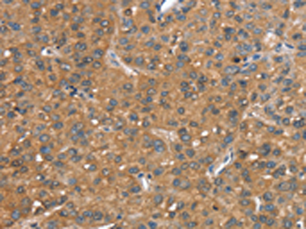 Rabbit Polyclonal Antibody to CR1