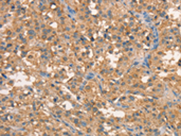 Rabbit Polyclonal Antibody to CRELD1