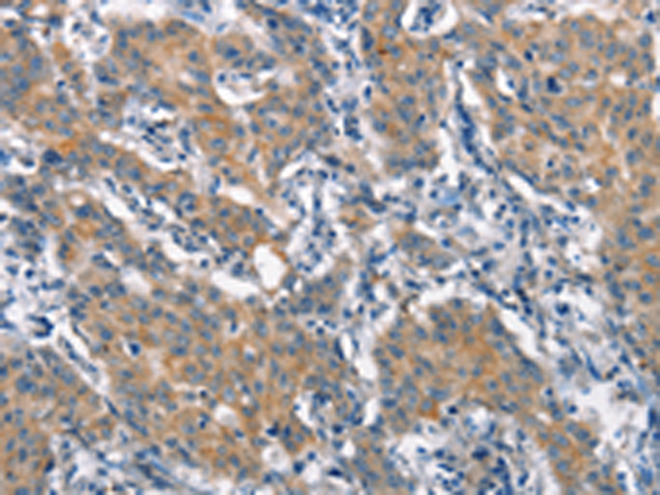 Rabbit Polyclonal Antibody to CRIM1