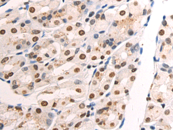 Rabbit Polyclonal Antibody to CDK12