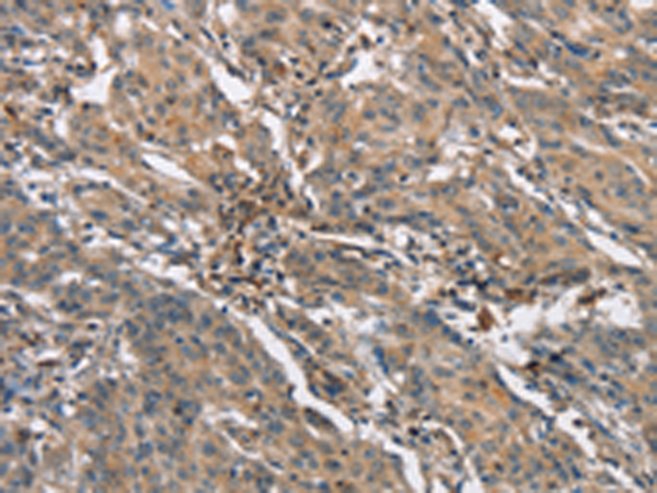 Rabbit Polyclonal Antibody to NLRP3