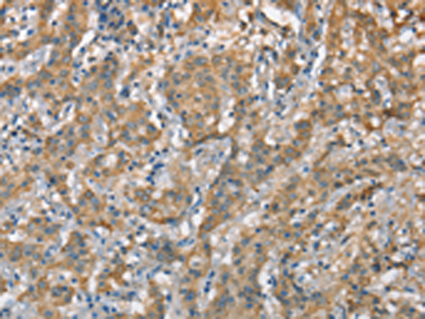 Rabbit Polyclonal Antibody to CSMD1