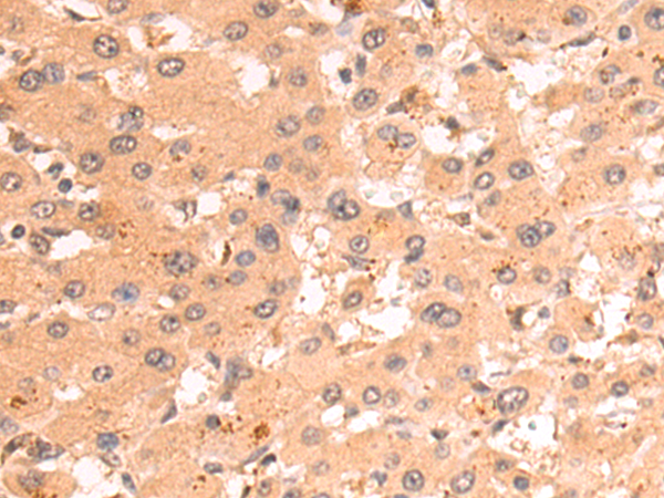 Rabbit Polyclonal Antibody to CTAG1A