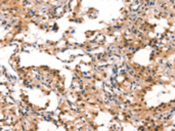 Rabbit Polyclonal Antibody to CUL4B