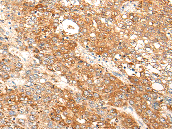 Rabbit Polyclonal Antibody to DIPK2B