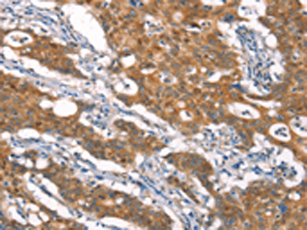 Rabbit Polyclonal Antibody to CYLD