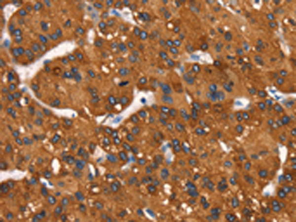 Rabbit Polyclonal Antibody to MT-CYB