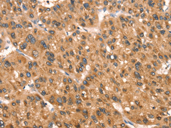 Rabbit Polyclonal Antibody to DAP