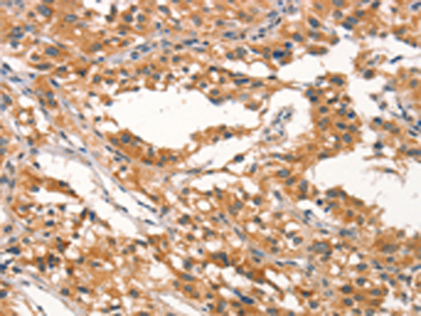 Rabbit Polyclonal Antibody to RHOBTB2