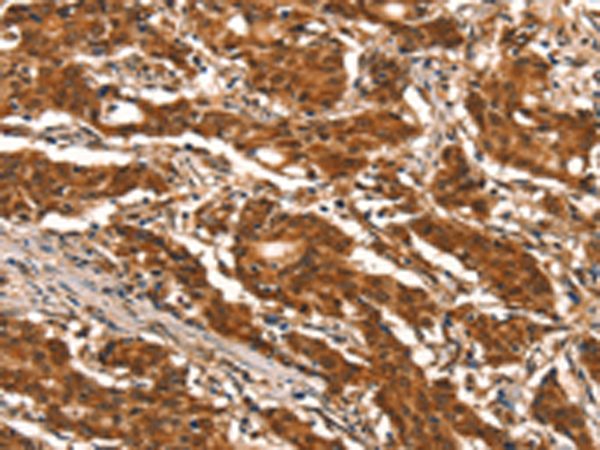 Rabbit Polyclonal Antibody to DDX4