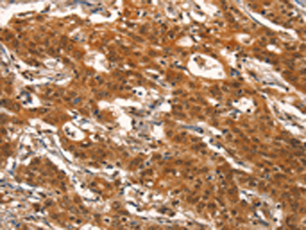 Rabbit Polyclonal Antibody to DEAF1