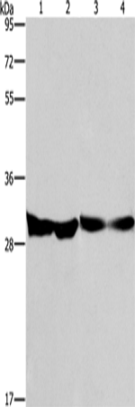 Rabbit Polyclonal Antibody to DECR1