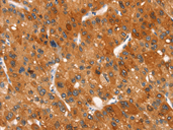 Rabbit Polyclonal Antibody to CLEC6A