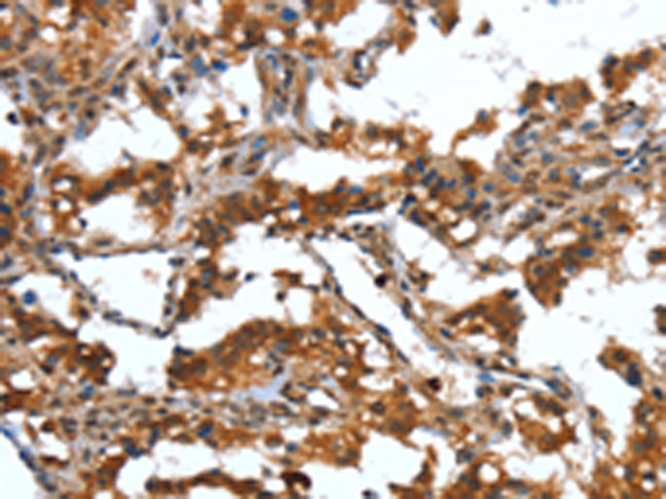 Rabbit Polyclonal Antibody to DEFA4