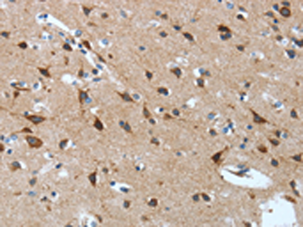 Rabbit Polyclonal Antibody to OPRD1
