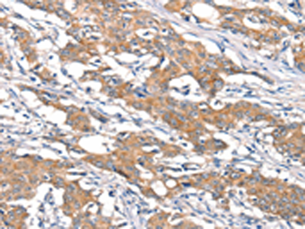 Rabbit Polyclonal Antibody to DSC1