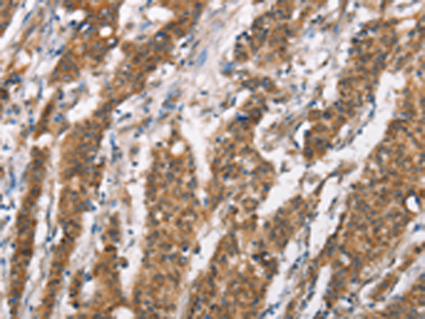 Rabbit Polyclonal Antibody to DSC2
