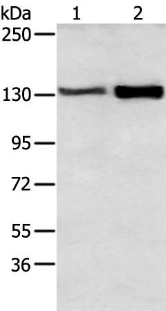 Rabbit Polyclonal Antibody to DSG3