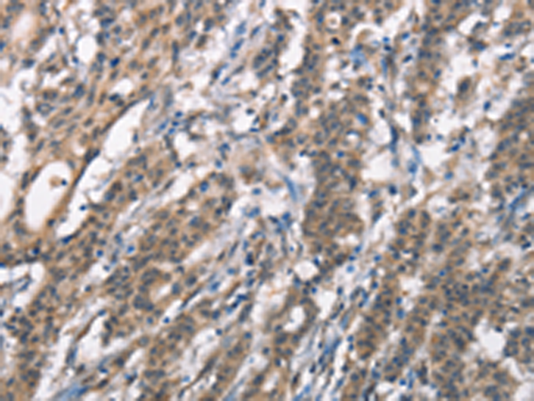 Rabbit Polyclonal Antibody to DGAT1