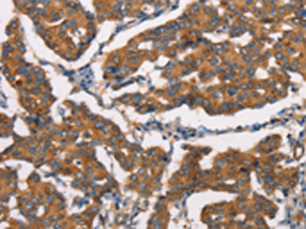 Rabbit Polyclonal Antibody to DICER1
