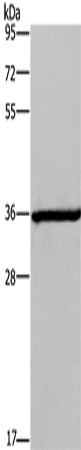 Rabbit Polyclonal Antibody to DIO2