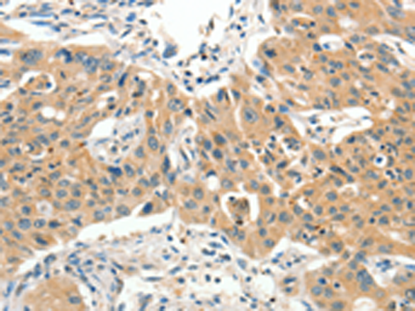 Rabbit Polyclonal Antibody to SLC11A2