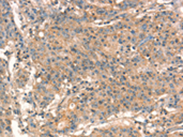 Rabbit Polyclonal Antibody to STK17A
