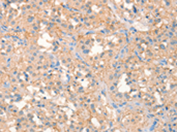 Rabbit Polyclonal Antibody to KCNB1