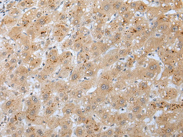 Rabbit Polyclonal Antibody to KCNB1